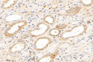 Immunohistochemistry analysis of paraffin-embedded human kidney using,IVD (ABIN7074382) at dilution of 1: 2800 (IVD antibody)