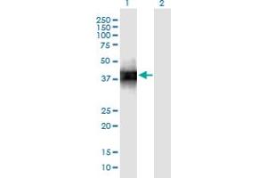 Western Blot analysis of SFTPB expression in transfected 293T cell line by SFTPB monoclonal antibody (M01), clone 1H7. (SFTPB antibody  (AA 1-381))