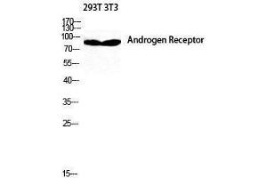 Western Blotting (WB) image for anti-Androgen Receptor (AR) (Ser154) antibody (ABIN3180493) (Androgen Receptor antibody  (Ser154))
