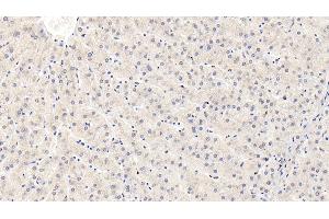Detection of IGFBP3 in Human Liver Tissue using Monoclonal Antibody to Insulin Like Growth Factor Binding Protein 3 (IGFBP3) (IGFBP3 antibody  (AA 135-277))