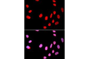 Immunofluorescence analysis of U2OS cells using CDC25C antibody (ABIN4903216). (CDC25C antibody)
