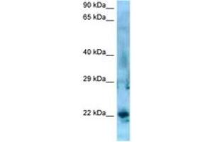 Image no. 1 for anti-Synovial Sarcoma, X Breakpoint 5 (SSX5) (AA 119-168) antibody (ABIN6748426) (SSX5 antibody  (AA 119-168))
