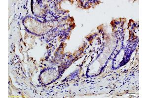 Immunohistochemistry (IHC) image for anti-Chemokine (C-C Motif) Ligand 19 (CCL19) (AA 26-108) antibody (ABIN740505)