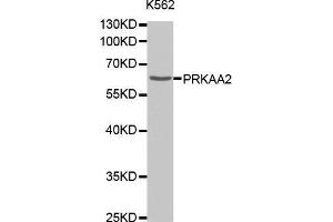 Western Blotting (WB) image for anti-Protein Kinase, AMP-Activated, alpha 2 Catalytic Subunit (PRKAA2) antibody (ABIN1678656) (PRKAA2 antibody)