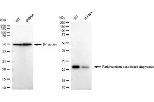 Western blotting analysis using Parkinsonism associated deglycase antibody (ABIN7800048).