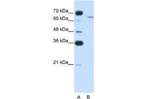 WB Suggested Anti-CPEB2 Antibody Titration:  0.