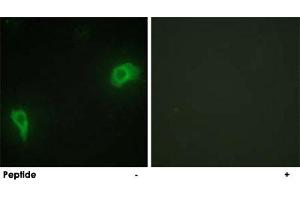 Immunofluorescence analysis of HepG2 cells, using DOK7 polyclonal antibody . (DOK7 antibody  (N-Term))