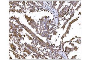 IHC analysis of LRP1B using anti-LRP1B antibody (ABIN7601521). (LRP1B antibody  (AA 3704-4547))