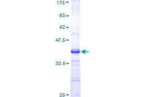Image no. 1 for V-Akt Murine Thymoma Viral Oncogene Homolog 1 (AKT1) (AA 381-480) protein (GST tag) (ABIN1344780) (AKT1 Protein (AA 381-480) (GST tag))