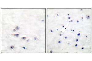 Immunohistochemical analysis of paraffin-embedded human brain tissue using Shc (phospho-Tyr427) antibody. (SHC1 antibody  (pTyr427))