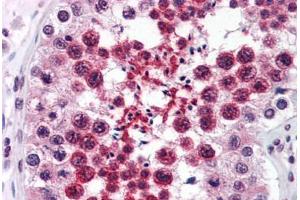 Human Testis (formalin-fixed, paraffin-embedded) stained with RTN4 antibody ABIN343915 at 3 ug/ml followed by biotinylated goat anti-rabbit IgG secondary antibody ABIN481713, alkaline phosphatase-streptavidin and chromogen. (Reticulon 4 antibody  (Internal Region))