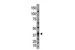 Image no. 1 for anti-Growth Differentiation Factor 1 (GDF1) (N-Term) antibody (ABIN357457) (GDF1 antibody  (N-Term))