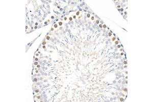 Immunohistochemistry of paraffin-embedded mouse lung using Phospho--S473 Rabbit mAb (ABIN6135179, ABIN6135970, ABIN6135971 and ABIN7101880) at dilution of 1:100 (40x lens). (AKT1 antibody  (pSer473))