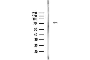 Western blot analysis of lysates from Mouse liver, using Phospho-Ezrin (Tyr146) Antibody at 1/1000 dilution.