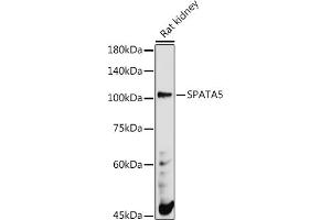 Western blot analysis of extracts of Rat kidney, using SP antibody (ABIN7270524) at 1:500 dilution. (SPATA5 antibody)