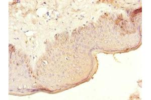 Immunohistochemistry of paraffin-embedded human skin tissue using ABIN7148625 at dilution of 1:100