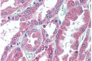 Human Kidney (formalin-fixed, paraffin-embedded) stained with COL18A1 antibody ABIN305768 at 10 ug/ml followed by biotinylated goat anti-rabbit IgG secondary antibody ABIN481713, alkaline phosphatase-streptavidin and chromogen. (COL18A1 antibody  (C-Term))