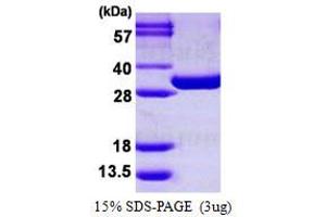 Image no. 1 for phosphoglycerate Mutase 1 (Brain) (PGAM1) protein (His tag) (ABIN1098606) (PGAM1 Protein (His tag))