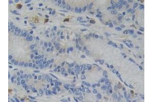 Detection of GR in Human Stomach Tissue using Polyclonal Antibody to Glucocorticoid Receptor (GR) (Glucocorticoid Receptor antibody  (AA 598-755))