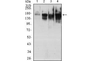 Western Blotting (WB) image for anti-Topoisomerase (DNA) II alpha 170kDa (TOP2A) (AA 1100-1530) antibody (ABIN7193523)