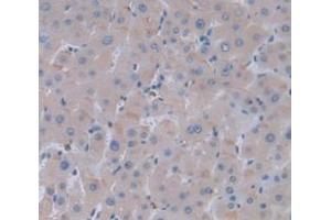 Figure. (Thymidine Phosphorylase antibody  (AA 38-247))