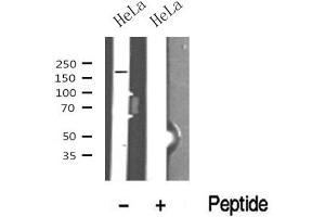 Western blot analysis of TOPBP1 in lysates of HeLa? (TOPBP1 antibody  (Internal Region))