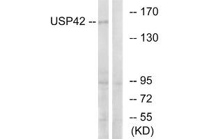 Western blot analysis of extracts from HT-29 cells, using USP42 antibody.