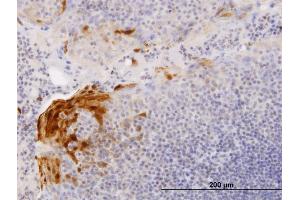 Immunoperoxidase of purified MaxPab antibody to S100A7 on formalin-fixed paraffin-embedded human tonsil. (S100A7 antibody  (AA 1-101))