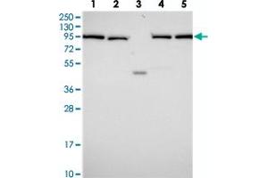 Western blot analysis of Lane 1: RT-4, Lane 2: U-251 MG, Lane 3: Human Plasma, Lane 4: Liver, Lane 5: Tonsil with INO80D polyclonal antibody . (IN80D antibody)