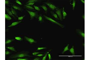 Immunofluorescence of purified MaxPab antibody to BIN1 on HeLa cell. (BIN1 antibody  (AA 1-482))
