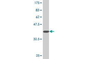 Western Blot detection against Immunogen (32. (SLC25A18 antibody  (AA 124-184))