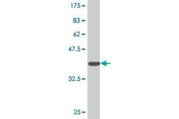 SLC25A18 antibody  (AA 124-184)