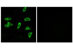 Immunofluorescence analysis of LOVO cells, using PTGER3 antibody. (PTGER3 antibody  (N-Term))