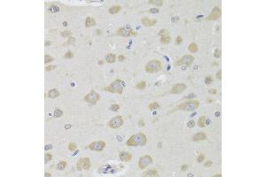 Immunohistochemistry of paraffin-embedded rat brain using DHRS9 Antibody (ABIN5973740) at dilution of 1/100 (40x lens). (DHRS9 antibody)
