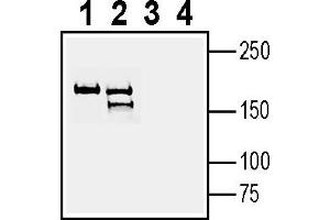 anti-Latrophilin 3 (LPHN3) (AA 572-586) antibody