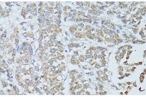 Immunohistochemistry (Paraffin-embedded Sections) (IHC (p)) image for anti-Transcription Elongation Factor, Mitochondrial (TEFM) antibody (ABIN7264563)