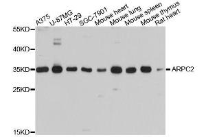 Western blot analysis of extracts of various cell lines, using ARPC2 antibody. (ARPC2 antibody  (AA 1-300))
