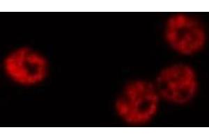ABIN6268809 staining K-562 cells by IF/ICC. (HNRNPC antibody  (C-Term))