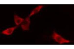 ABIN6268850 staining A549 cells by IF/ICC. (DCT antibody  (N-Term))