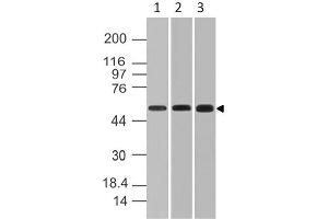 Image no. 1 for anti-RanBP-Type and C3HC4-Type Zinc Finger Containing 1 (RBCK1) (AA 121-333) antibody (ABIN5027252) (RBCK1 antibody  (AA 121-333))