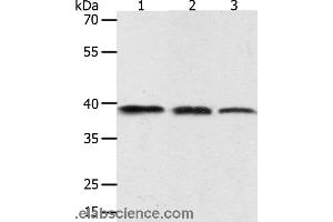 Western blot analysis of PC3 cell, human seminoma and mouse testis tissue, using AMD1 Polyclonal Antibody at dilution of 1:400