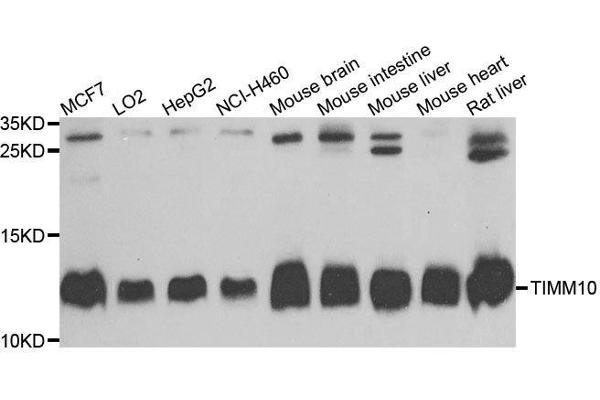 TIMM10 抗体  (AA 1-90)