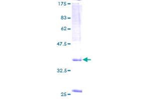 SPAG9 Protein (AA 1-131) (GST tag)