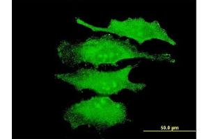 Immunofluorescence of monoclonal antibody to MAPK4 on HeLa cell. (MAPK4 antibody  (AA 42-151))