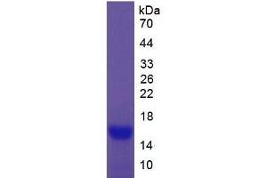 SDS-PAGE of Protein Standard from the Kit  (Highly purified E. (CEA ELISA Kit)