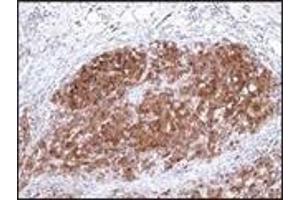 Immunohistochemistry (IHC) image for anti-S-100 (C-Term) antibody (ABIN870447) (S-100 antibody  (C-Term))