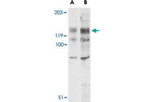 Western blot analysis of BUB1 in A-20 lysate with BUB1 polyclonal antibody  at (A) 2 and (B) 4 ug/mL . (BUB1 antibody  (N-Term))