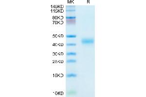 Kallikrein 5 Protein (KLK5) (AA 23-293) (His tag)