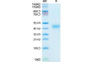Human Kallikrein 5 on Tris-Bis PAGE under reduced condition. (Kallikrein 5 Protein (KLK5) (AA 23-293) (His tag))