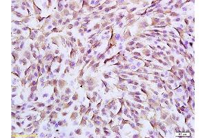 Immunohistochemistry (Paraffin-embedded Sections) (IHC (p)) image for anti-Vimentin (VIM) (AA 371-466) antibody (ABIN672786)